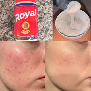 Cuidados naturais com a pele